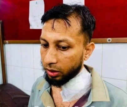 আড়াইহাজারে ডাকাত দলের হামলায় মুরাদনগরের এসিল্যান্ডসহ আহত- ৬
