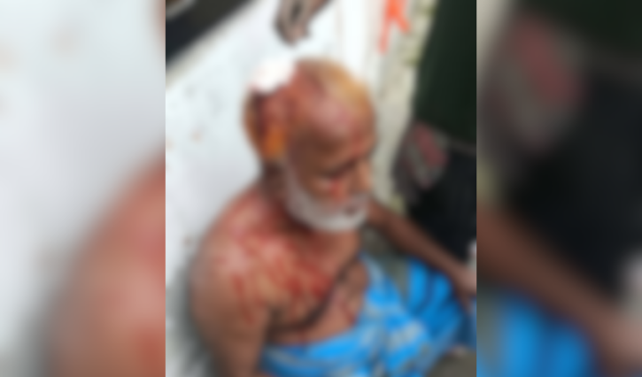 সিদ্ধিরগঞ্জে নারীসহ তিনজনের ওপর হামলার অভিযোগ