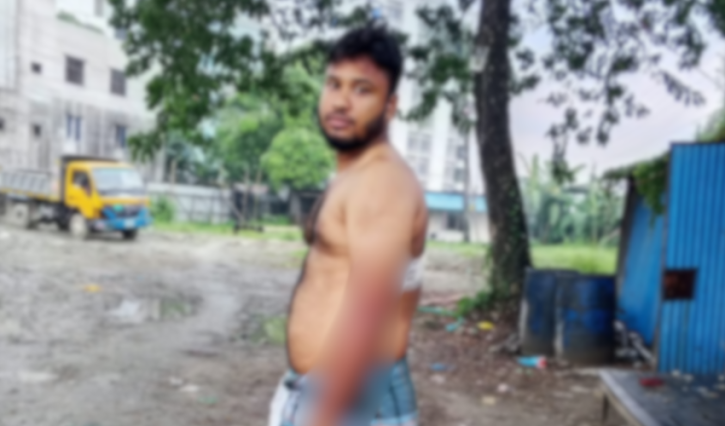 সিদ্ধিরগঞ্জে কৃষক দল নেতাকে কুপিয়ে জখম, ৮০ হাজার টাকা ছিনতাইয়ের অভিযোগ